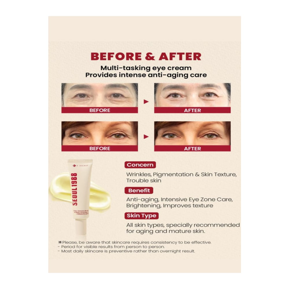 كريم العيون المضاد للشيخوخة بنسبة 4% - سيول 1988، 30 مل